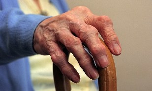 Yaşlı bir kişide parmak artriti ve artrozu