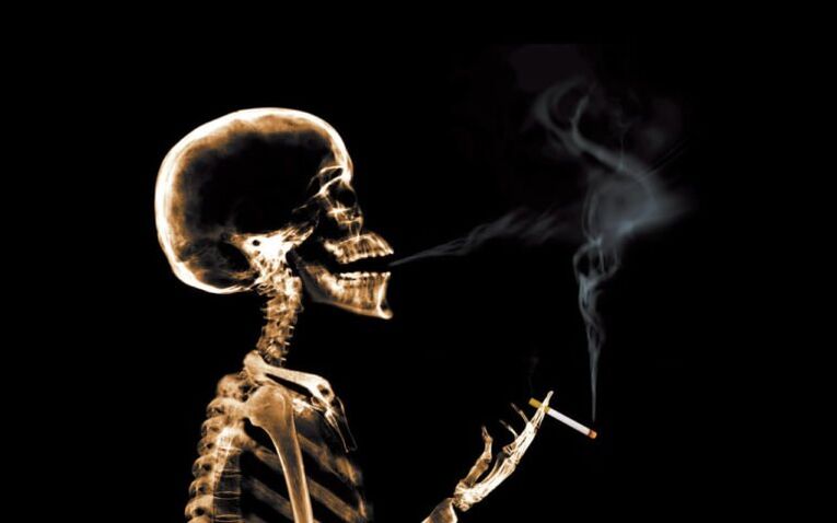 omuz bıçakları bölgesinde sırt ağrısı nedeni olarak sigara içmek