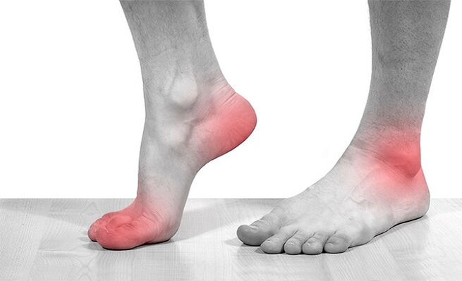 artrozlu ayak bileği eklemlerinde ağrı