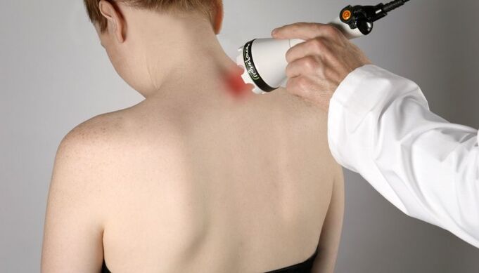 Servikal osteokondroz için lazer tedavisi