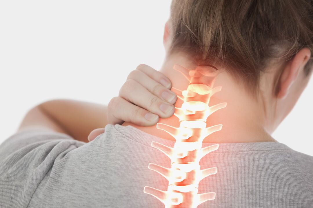 osteokondroz belirtileri